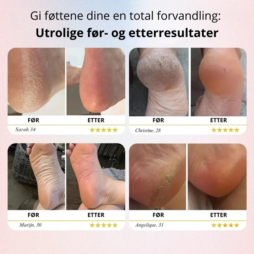 INOVAREC™ Elektrisk Fotfil – Glatt Hud På Sekunder